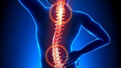 Mecanismo de desenvolvemento da osteocondrose