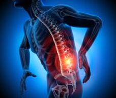diferentes causas de dores nas costas