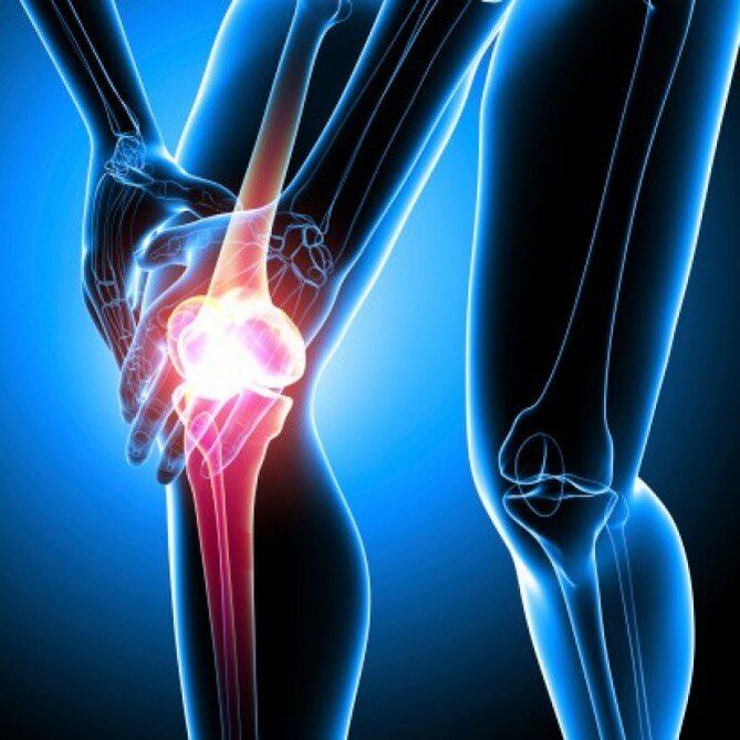 A artrite reumatoide en fases avanzadas pode causar dor de cadeira