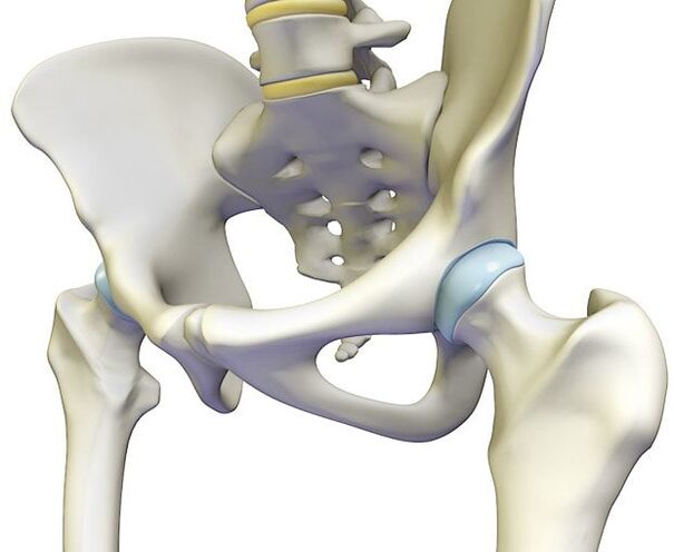 A osteocondrose provoca unha dor intensa na articulación da cadeira
