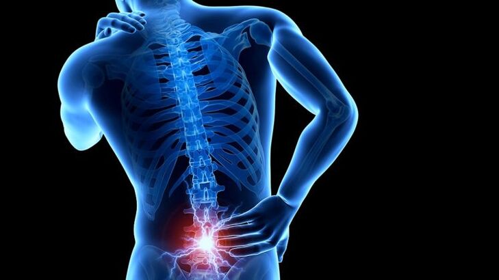 Dor de costas con osteocondrose lumbar